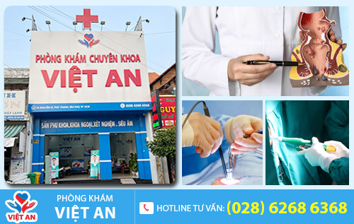 Địa chỉ điều trị polyp hậu môn hiệu quả
