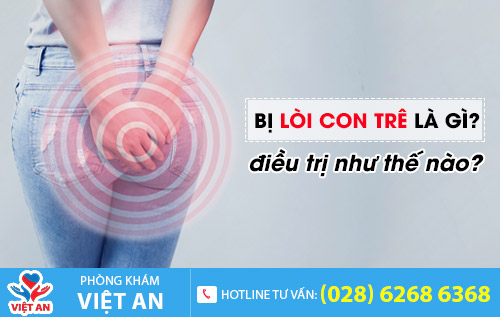 Bị lòi con trê là gì?