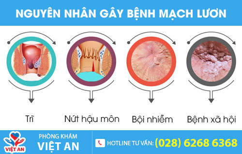 Nguyên nhân gây bệnh mạch lươn