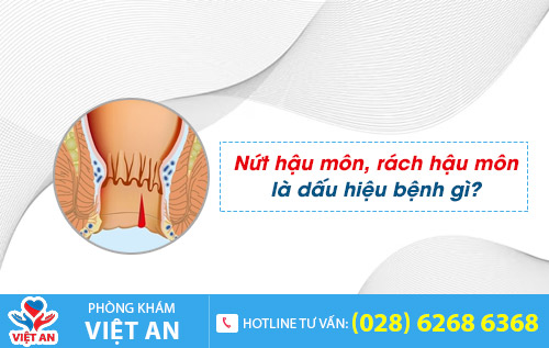 Nứt hậu môn, rách hậu môn