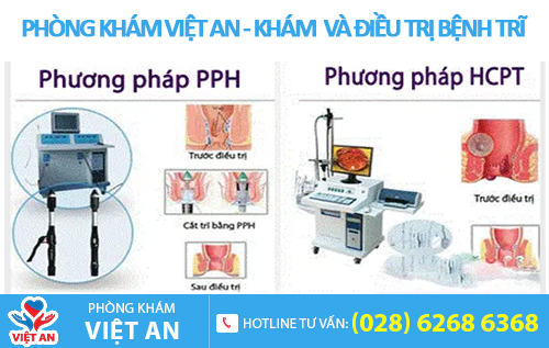 HCPT và PPH là 2 phương pháp chữa trĩ vượt trội nhất hiện nay