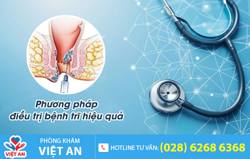 Phương pháp điều trị bệnh trĩ hiệu quả