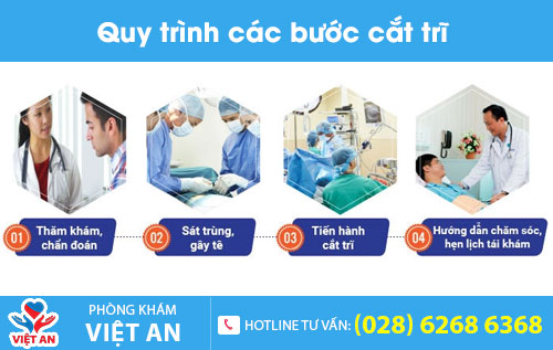 Quy trình cắt trĩ