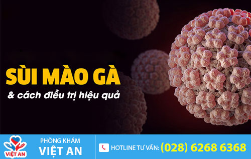 Sùi mào gà