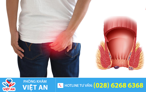 Sưng đau hậu môn có thể là dấu hiệu của nhiều bệnh lý nguy hiểm?