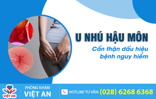 U nhú hậu môn