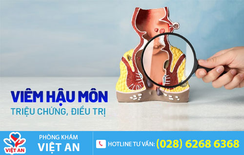 Viêm hậu môn