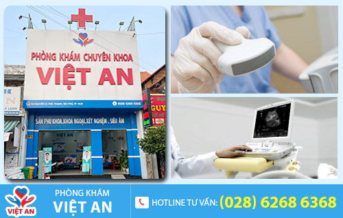 Địa chỉ siêu âm chuyên siêu âm - Phòng Khám Việt An