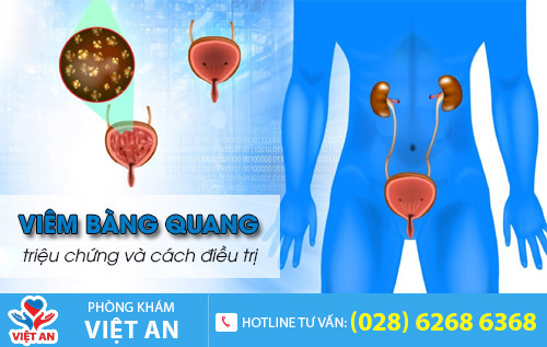 Viêm bàng quang